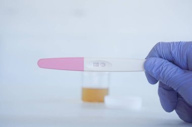 İdrar örneği konseptiyle idrar testi yapan bir tıp bilimcisi.