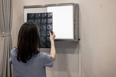 Hekim ve radyologlar, MRI filmi de dahil olmak üzere tıbbi görüntüleri analiz ederek, tedavi planlarını ve gelecekteki tıbbi prosedürleri geliştirmek ve hastaları uzman doktorlara yönlendirmek için hasta durumunu tanımlarlar..