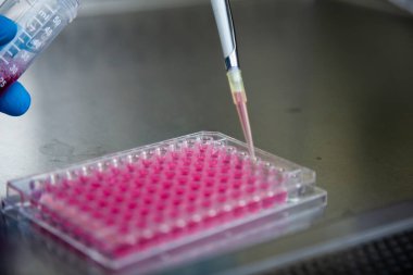 Laboratuvardaki hücre kültürü