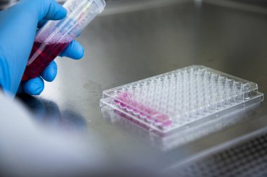 Laboratuvardaki hücre kültürü