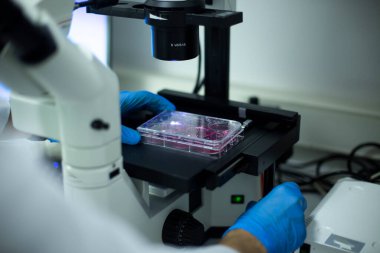 Laboratuvardaki hücre kültürü