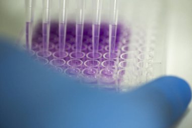 Tıp ve hücre kültürü laboratuarında hücre kültürü