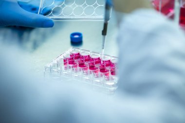 Laboratuvardaki hücre kültürü