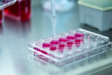 Laboratuvardaki hücre kültürü