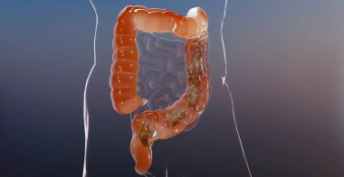 İnsan sindirim sistemi anatomisinin 3 boyutlu çizimi, bağırsak konsepti, müshil, kabızlık haini, 3 boyutlu canlandırma.