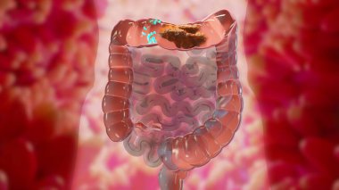 İnsan sindirim sistemi anatomisinin 3 boyutlu çizimi, bağırsak konsepti, müshil, kabızlık haini, 3 boyutlu canlandırma.