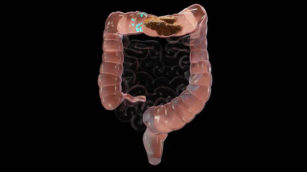 Ilustração Anatomia Sistema Digestivo Humano Conceito Intestino Laxante Traição Constipação — Fotografia de Stock
