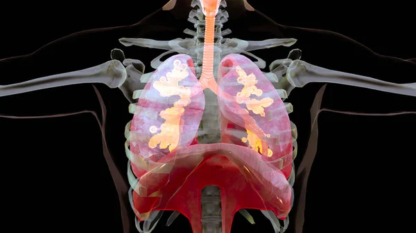 Illustration Des Human Respiratory System Lunge Anatomy Concept Sichtbare Lunge — Stockfoto