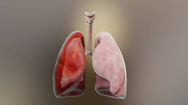 3D hemotoraks, normal akciğere karşı çökme, Hemothorax semptomları, plevral efüzyon, empyema, göğüs yaralanmasından sonraki komplikasyonlar, plevral boşlukta hava, 3D Render