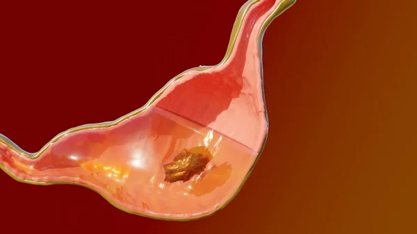 Illustratie Van Menselijke Maag Anatomie Digestie Reander3D Illustratie Van Menselijke — Stockfoto