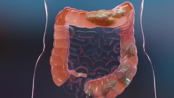 Anatomie Des Menschlichen Verdauungssystems Konzept Des Darms Alpha Kanal Abführmittel — Stockvideo