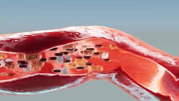 天然痘の伝染のパンデミック 天然痘細胞 症状や予防措置 天然痘の変種 変異発熱猿 人間の健康へのウイルスの脅威 3Dレンダリング — ストック動画