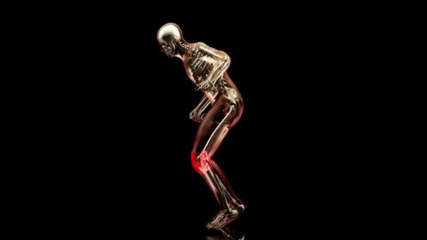 膝の損傷を実行しているスポーツの痛みに苦しんで走行中に痛みを伴う関節を持っている男 ジョギング傷害 訓練された人の上に 医学的に正確です 3Dレンダリング — ストック動画