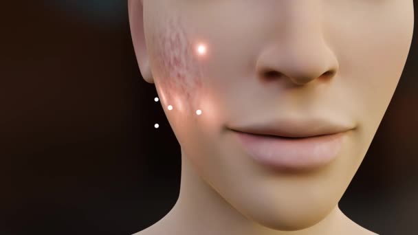 피부의 먼지를 제거하는 효과를 여드름 배경을 청소하는 사용됩니다 얼굴에 크림이나 — 비디오