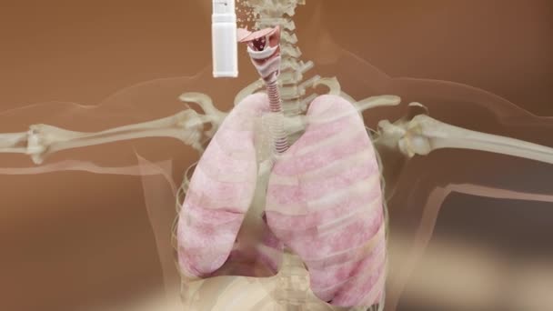 Astmasymtom Behandling Bronkiol Astmainhalator Astmaattack — Stockvideo