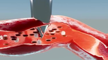 Hemostasis. Kan damarlarında kırmızı kan hücreleri ve trombositler var. Yaraların iyileşme sürecinin temel adımları. Animasyon. 3 boyutlu görüntüleme. kesit