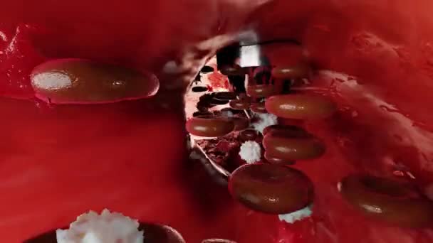 Hemostaza Czerwone Krwinki Płytki Krwi Naczyniu Krwionośnym Podstawowe Etapy Procesu — Wideo stockowe