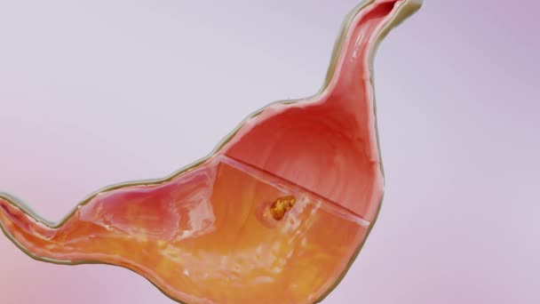 Menselijke Maag Anatomie Slikken Spijsvertering Renderen — Stockvideo