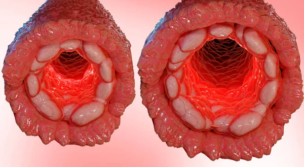 vasoconstriction and vasodilation blood pressure, dilated blood vessels or capillaries or artery, Increase and decrease in blood flow through the blood vessels, Different thickness, 3d render