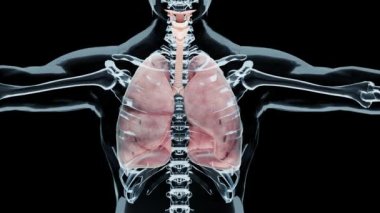 Pnömotoraks, hemotoraks ve Hemopnömotoraks, normal akciğere karşı baygınlık, pnömotoraks semptomları, plevral efüzyon, empyema, göğüs yaralanmasından sonra komplikasyonlar, 3D