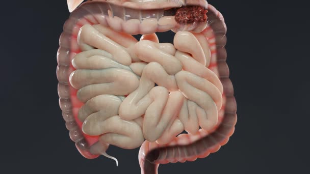 Human Anatomy Digestion Concept Intestine Laxative Traitement Constipation Esophagus Swallowing — Stockvideo