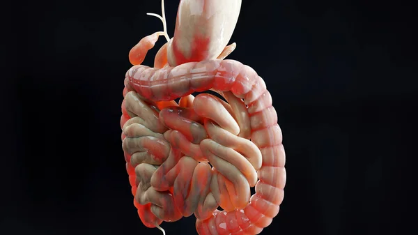 Crohns hastalığından muzdarip bir adam, erkek anatomisi, iltihaplı kalın bağırsak, Sigmoid kolon, insan sindirim sistemi parçaları, 3D