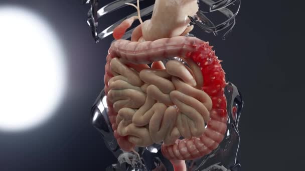 Anatomy Human Digestive System Concept Intestine Diverticulitis Render — Vídeo de Stock
