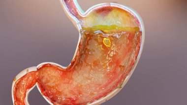 Gazlı insan midesi. Şişkinlik ve gaz çıkarma, gaz çıkarma ve gastrointestinal sistem, şişme sindirim sistemi, mide ağrısı veya kramplar, mide iltihabı, mide ağrısı, hazımsızlık, kusma, 3D render.