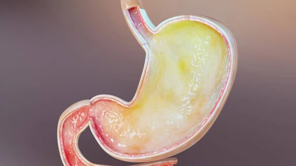 Gazlı insan midesi. Şişkinlik ve gaz çıkarma, gaz çıkarma ve gastrointestinal sistem, şişme sindirim sistemi, mide ağrısı veya kramplar, mide iltihabı, mide ağrısı, hazımsızlık, kusma, 3D render.