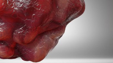 Doku, tümör enfeksiyonu hücreleri ve yayılan, iltihaplı metastaz kanserli kanser hücreleri üzerinde kontrol edilemeyen kanser hücresi büyümesi. Çoğaltılarak çoğaltılıyor, hücreler genişliyor, Melanoma Kanseri, 3 boyutlu canlandırma