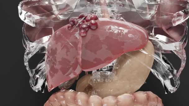 Spijsverteringsorgaan Leverkanker Hepatitis Cirrose Kwaadaardige Tumor Leverfalen Groeiende Cellen Dupliceren — Stockvideo