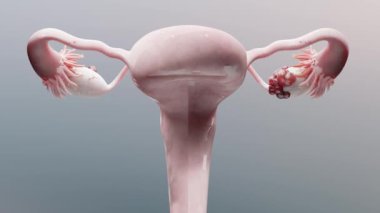 Yumurtalık tümörü, kadın rahim anatomisi, üreme sistemi, kanser hücreleri, yumurtalık kistleri, rahim kanseri, büyüyen hücreler, jinekolojik hastalıklar, metastaz kanseri, Alpha Channel, 3D render