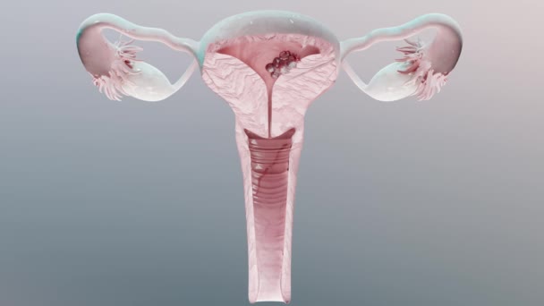 生殖系 がん細胞 卵巣細胞 子宮頸がん 成長細胞 婦人科疾患 転移がん 3Dレンダリング — ストック動画