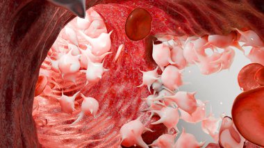 Hemostasis. Red blood cells and platelets in the blood vessel, vasoconstriction, wound healing process. hemorrhage clot embolisms, Hemophilia. fibrinolysis, injury bleeding coagulation, 3d render clipart