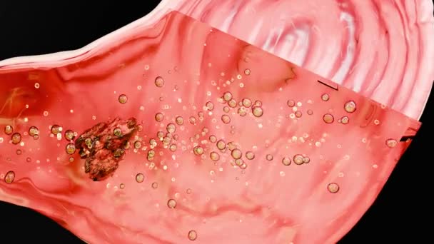 Villi Intestinali Microvili Roșii Într Tract Intestinal Close Microbiologie Anatomie — Videoclip de stoc