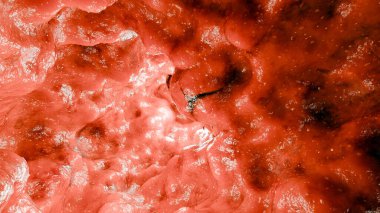 Bağırsak rengi, kolon dalgalanması, vajinal kas hareketi, pelvik zemin kasları, pelvik organ sarkması, Kegel egzersizleri, bağırsak iltihabı bağırsak iltihabı hastalığı, kolonoskopi, 3D canlandırma.