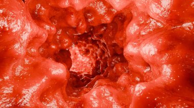 Bağırsak rengi, kolon dalgalanması, vajinal kas hareketi, pelvik zemin kasları, pelvik organ sarkması, Kegel egzersizleri, bağırsak iltihabı bağırsak iltihabı hastalığı, kolonoskopi, 3D canlandırma.