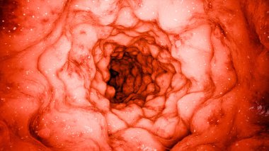 Bağırsak rengi, kolon dalgalanması, vajinal kas hareketi, pelvik zemin kasları, pelvik organ sarkması, Kegel egzersizleri, bağırsak iltihabı bağırsak iltihabı hastalığı, kolonoskopi, 3D canlandırma.