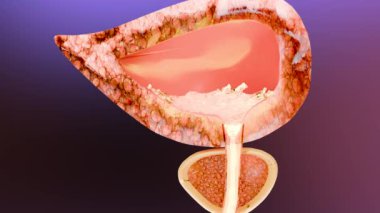 İdrar yolu ya da dışkılama sistemi, erkek mesanesi ve prostat bezi anatomisi, üroloji tıbbi, üreme, neffoloji, Prostatitis 'in enine kesiti, üretra ve seminal vesicle, 3D render