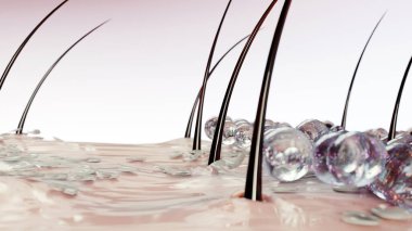 Kepeğe karşı tedavi, Serum beslenme, cilt iltihabı, saç bakımı. Kepek önleyici, şampuan saç ve kafa derisindeki kepeği çıkarır, hasarlı saç ve deriyi onarır, tıbbi güzellik konsepti, 3D