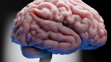 İnsan beyin sinir sistemi anatomisi, sinirsel kanser, yağlı ampul, beyin kanseri tümörü habis hücreler büyüyüp yayılıyor, menenjiyom, nörolojik hastalık, metastaz kanseri, serebrum, 3D render
