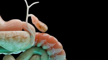 Gallstones in the gallbladderand bile duct, human silhouette and anatomy of surrounding organs, liver and gallbladder with stones, Realistic 3D Render