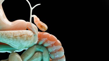 Gallstones in the gallbladderand bile duct, human silhouette and anatomy of surrounding organs, liver and gallbladder with stones, Realistic 3D Render