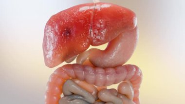 Sindirim Organ Karaciğeri Kanseri, Hepatit sirozu habis tümör, Hepatik yetmezliği, büyüme hücreleri, çoğalma, fibroz, siroz, Hepatosel karsinom, Virüs enfekte olmuş karaciğer, insan, 3D