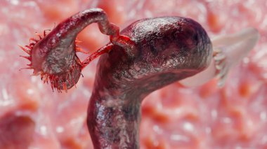 Yumurtalık tümörü, kadın rahim anatomisi, üreme sistemi, kanser hücreleri, yumurtalık kistleri, rahim kanseri, büyüyen hücreler, jinekolojik hastalıklar, metastaz kanseri, çoğalma, üç boyutlu işleme