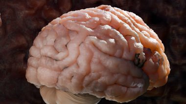 İnsan beyin sinir sistemi anatomisi, sinirsel kanser, yağlı ampul, beyin kanseri tümörü habis hücreler büyüyüp yayılıyor, menenjiyom, nörolojik hastalık, metastaz kanseri, serebrum, 3D render