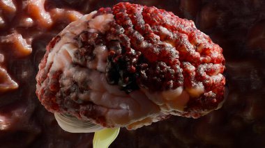 İnsan beyin sinir sistemi anatomisi, sinirsel kanser, yağlı ampul, beyin kanseri tümörü habis hücreler büyüyüp yayılıyor, menenjiyom, nörolojik hastalık, metastaz kanseri, serebrum, 3D render