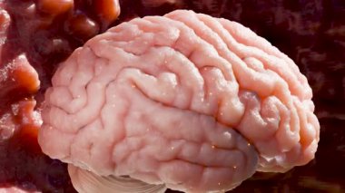 İnsan beyin sinir sistemi anatomisi, sinirsel kanser, yağlı ampul, beyin kanseri tümörü habis hücreler büyüyüp yayılıyor, menenjiyom, nörolojik hastalık, metastaz kanseri, serebrum, 3D render