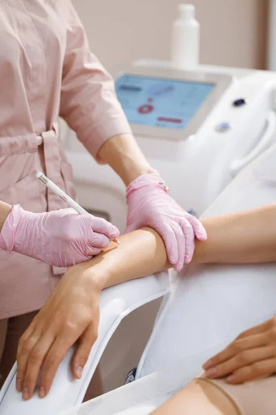 Laser hair removal specialist draws on moles on the womans hand with a protective pencil. Womens hands in gloves mark the area for epilation and protection of moles with a pencil.