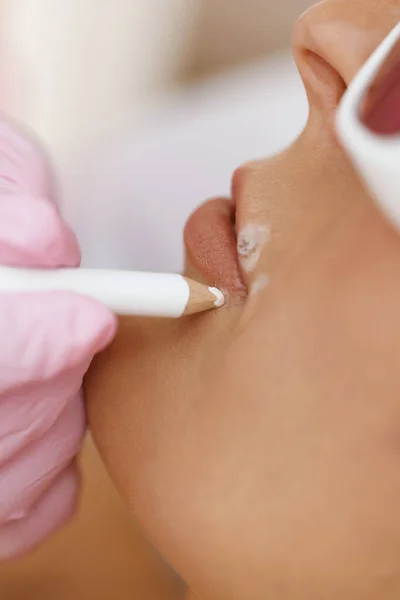 Laser hair removal specialist draws on moles on the womans face with a protective pencil. Womens hands in gloves mark the area for epilation and protection of moles with a pencil. Laser hair removal